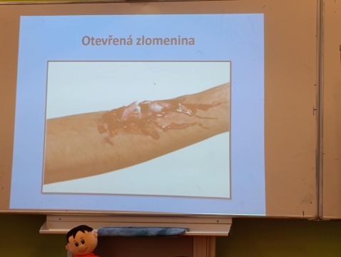 Obrázek v galerii